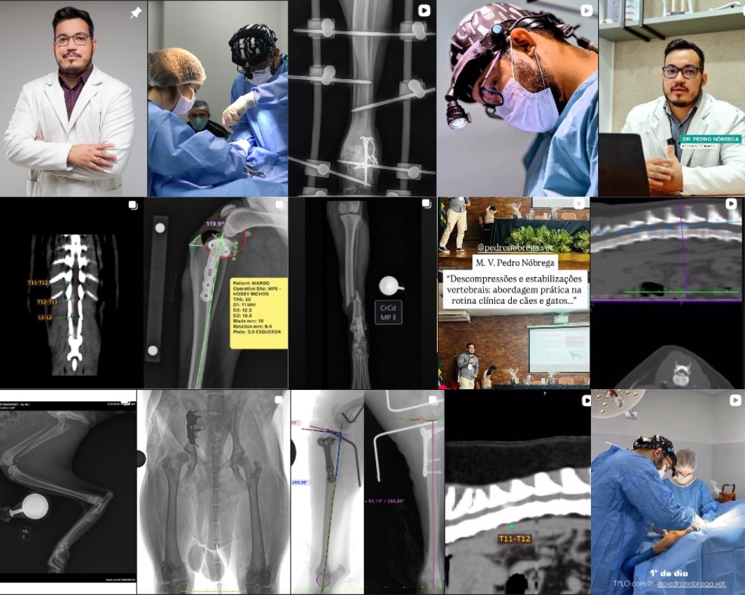 Seleção de publicações reais do Instagram do Dr. Pedro Nóbrega, com consultas, cirurgias e exames